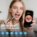 NNETM Visual Tonsil Cleaner Kit
