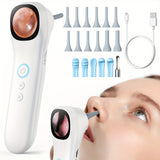 NNETM 5-in-1 Smart Ear Camera – 1080P HD Visual Ear Cleaner with Screen & Tools