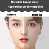 NNEOBA Face Lifting Roller – 3D Y-Shape EMS Microcurrent Facial Massager