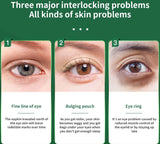 NNEOBA Anti-Wrinkle Photon Therapy Facial & Eye Massager Green
