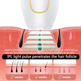 NNEOBA Professional IPL Laser Hair Removal Handset Permanent White
