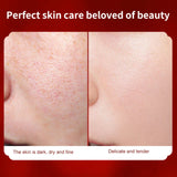 NNEOBA Placenta Essence Dragon's Blood Face Cream: Anti-Aging Marvel