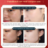 NNEOBA Placenta Essence Dragon's Blood Face Cream: Anti-Aging Marvel