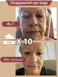 NNEOBA Anti-Wrinkle Eye Cream - Bags, Puffiness, Dark Circles, Fine Lines, Moisturizing, Whitening