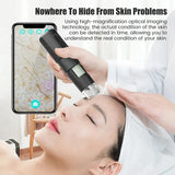 NNEOBA Wireless 1000X Scalp & Skin Analyzer Microscope