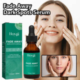 NNEOBA Dark Spot Remover Serum - Targets Sun Spots, Melasma, Freckles