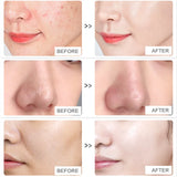 NNEOBA Amino Acid Facial Cleanser: Specialized Whitening for Women and Genuine Oil Control for Men