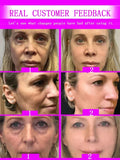 NNEOBA Instant Wrinkle Relief: Korea Cosmetic Anti-Aging Serum