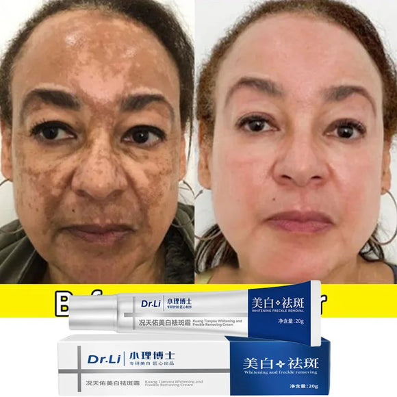 NNEOBA Whitening Freckles Cream - Korean Skincare
