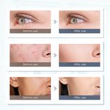 NNEOBA 7 Colors LED Face & Neck Mask - Phototherapy for Skin Rejuvenation