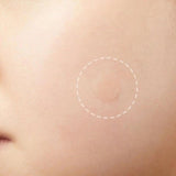 3-Piece Acne Treatment Set For Scars And Pimples-1915197382761517058