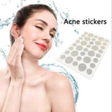 3-Piece Acne Treatment Set For Scars And Pimples-1915197382761517062