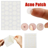 3-Piece Acne Treatment Set For Scars And Pimples-1915197382761517063