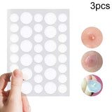 3-Piece Acne Treatment Set For Scars And Pimples-1915197382761517056