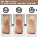 Electric Foot File Hard Skin Remover - Ergonomic Handle Design Foot Callus Remover - Rechargeable Foot File Heel Scraping