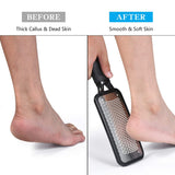 Foot Callus Remover Foot Scrubber Dead Skin Remover Foot File Heel Scraper for Cracked Heels Foot Exfoliator