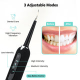 NNEDSZ High Frequency Electric Ultrasonic Dental Tartar Plaque Calculus Tooth Remover Set Kits Cleaner with LED Screen Black