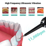 NNEDSZ High Frequency Electric Ultrasonic Dental Tartar Plaque Calculus Tooth Remover Set Kits Cleaner with LED Screen White
